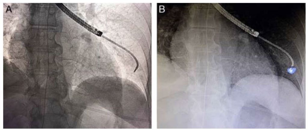 Fluoroscopy Comparison